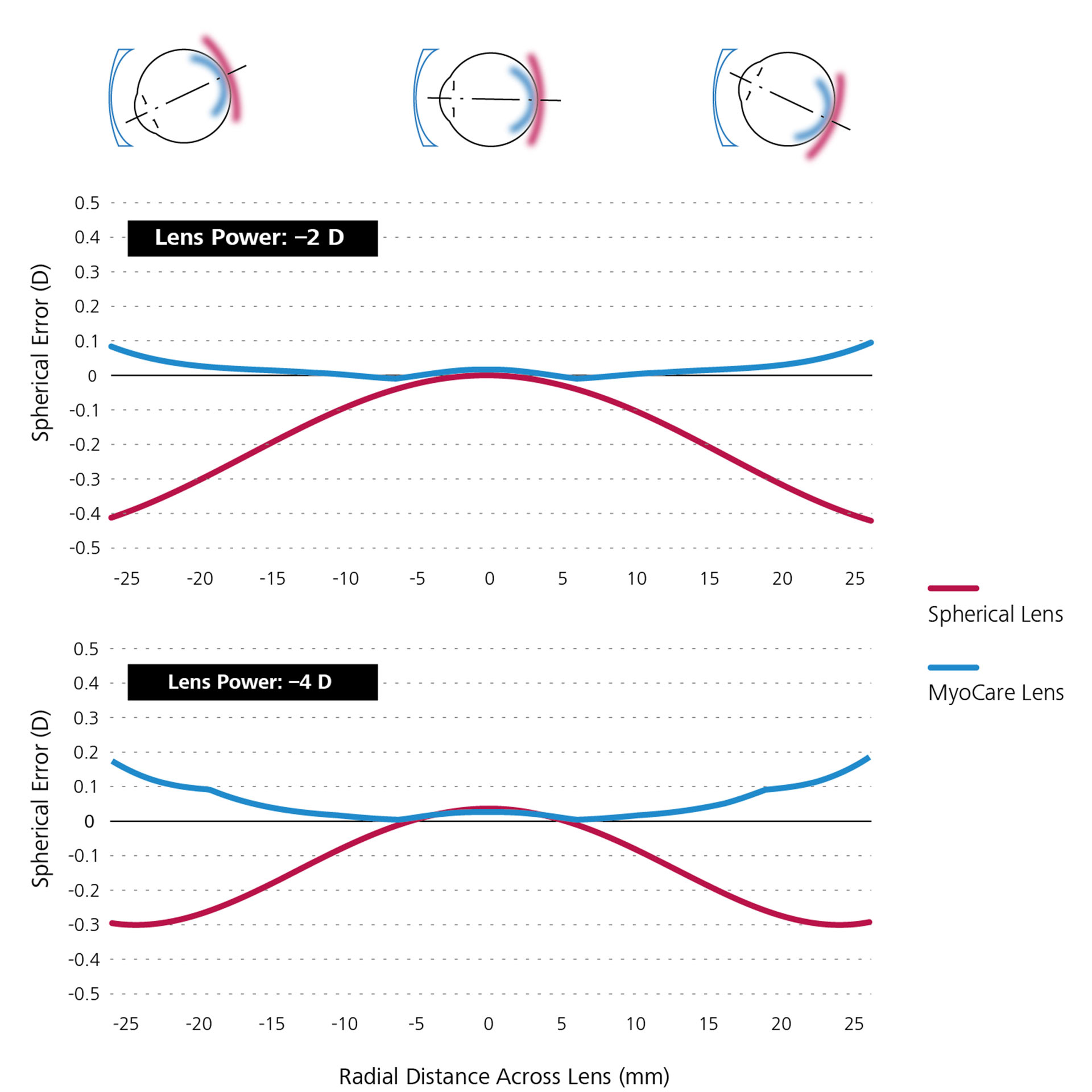 Két vonaldiagram, amelyek a szférikus egyfókuszú lencsék (piros) és a MyoCare lencsék (kék) összehasonlító optikai szimulációját mutatják be.