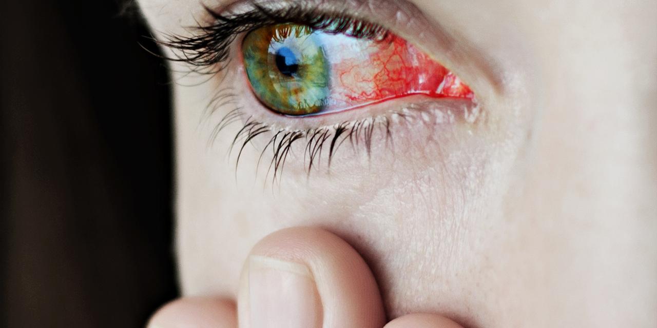 Uveitis, uveagyulladás