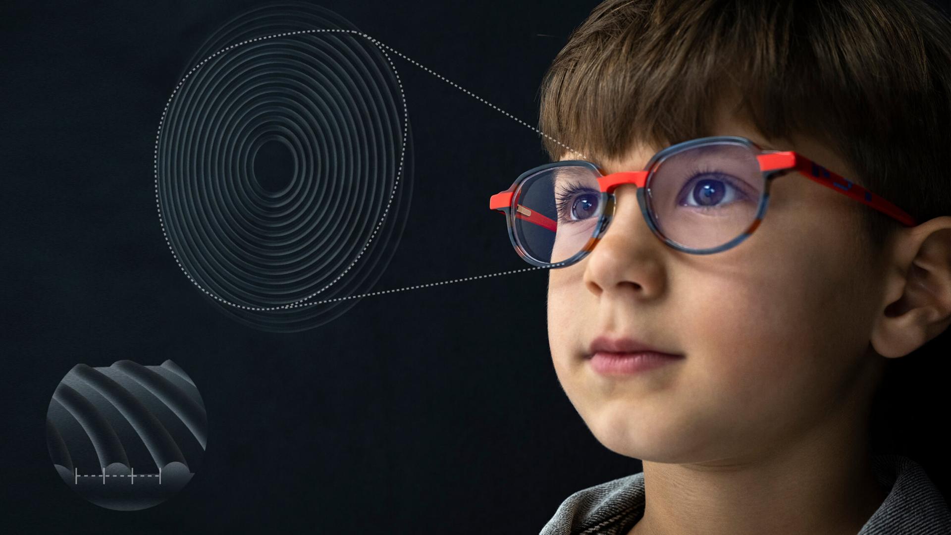 Közeli illusztráció a ZEISS MyoCare lencse kialakításáról, amelyet a gyermekkori rövidlátás fokozódásának kezelésére alakítottak ki.