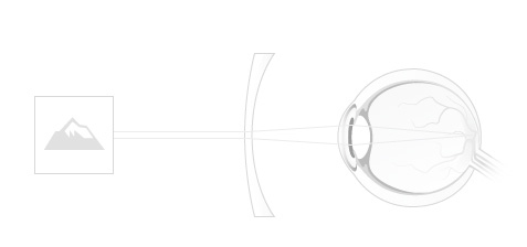 Nightingale Optika - Látásproblémák és tüneteik