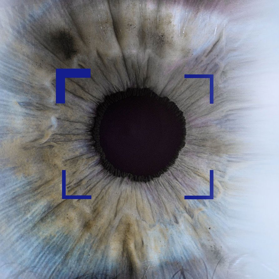 A ZEISS i.Scription technológia